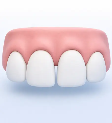 Illustration of a small gap between the two upper front teeth
